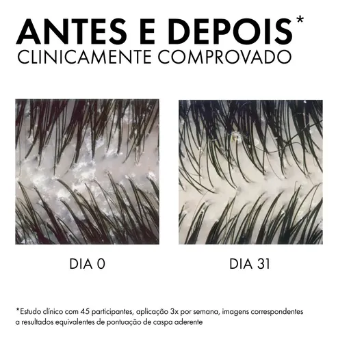 Shampoo Anticaspa para Normais a Oleosos com Selênio DS, DS Dercos Vichy, 300ml 5